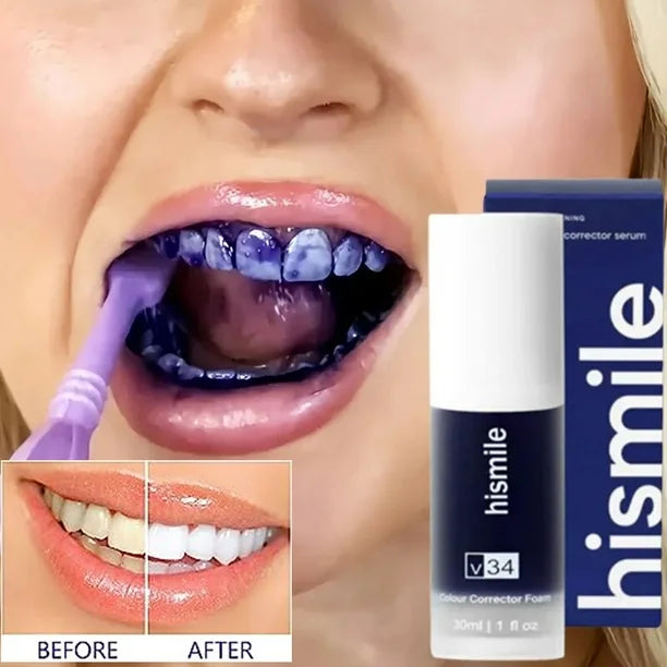 Tratamiento blanqueador de dientes Hi Smile Importaded edition